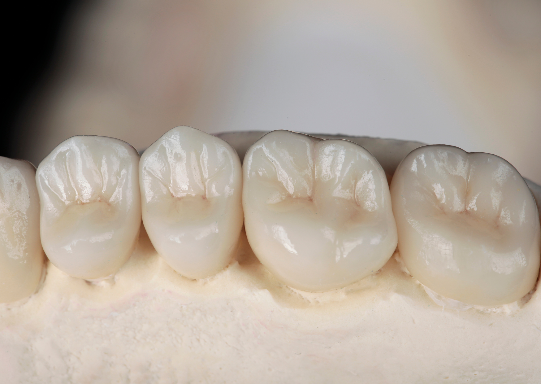 A close view shows a row of glossy ivory-colored molar-shaped teeth set into a pale model base. The teeth fill most of the frame against a soft, out-of-focus brown background. No tools or legible text are visible.