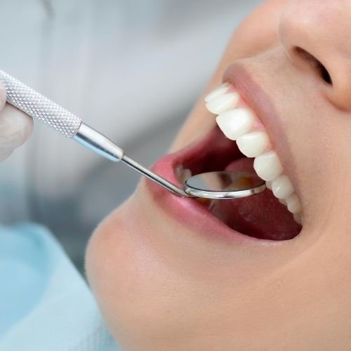 A cropped close-up shows an open mouth and teeth during an examination. A metal dental mirror is held beside the teeth by a gloved hand entering from the left. Blue fabric and a pale background surround the mouth.