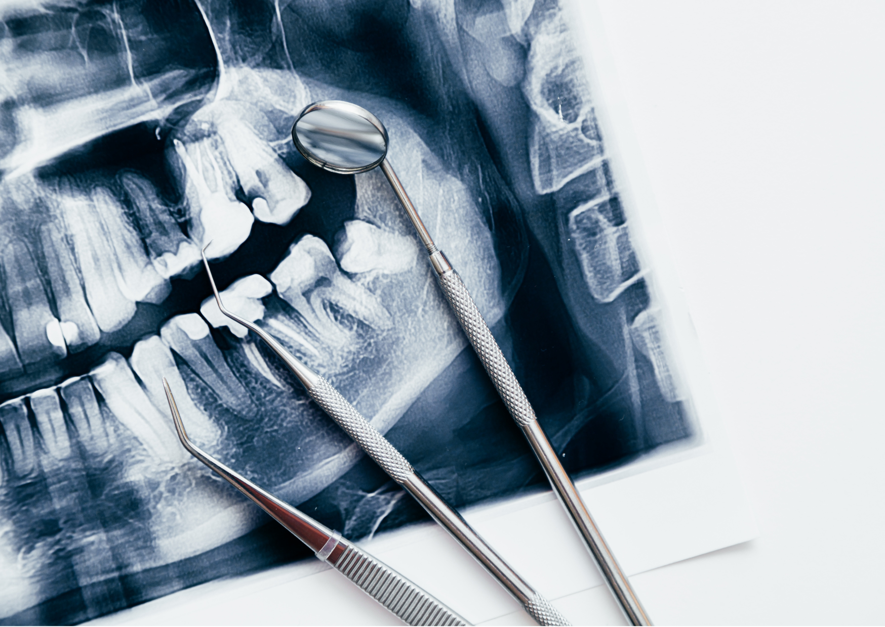 A cool blue-gray radiograph showing several teeth and part of a jaw fills the left and upper areas of the image. Two metal dental instruments cross the lower portion, and a round mirror sits over the radiograph near the center. A pale border and open white area remain along the right edge, with no legible text.
