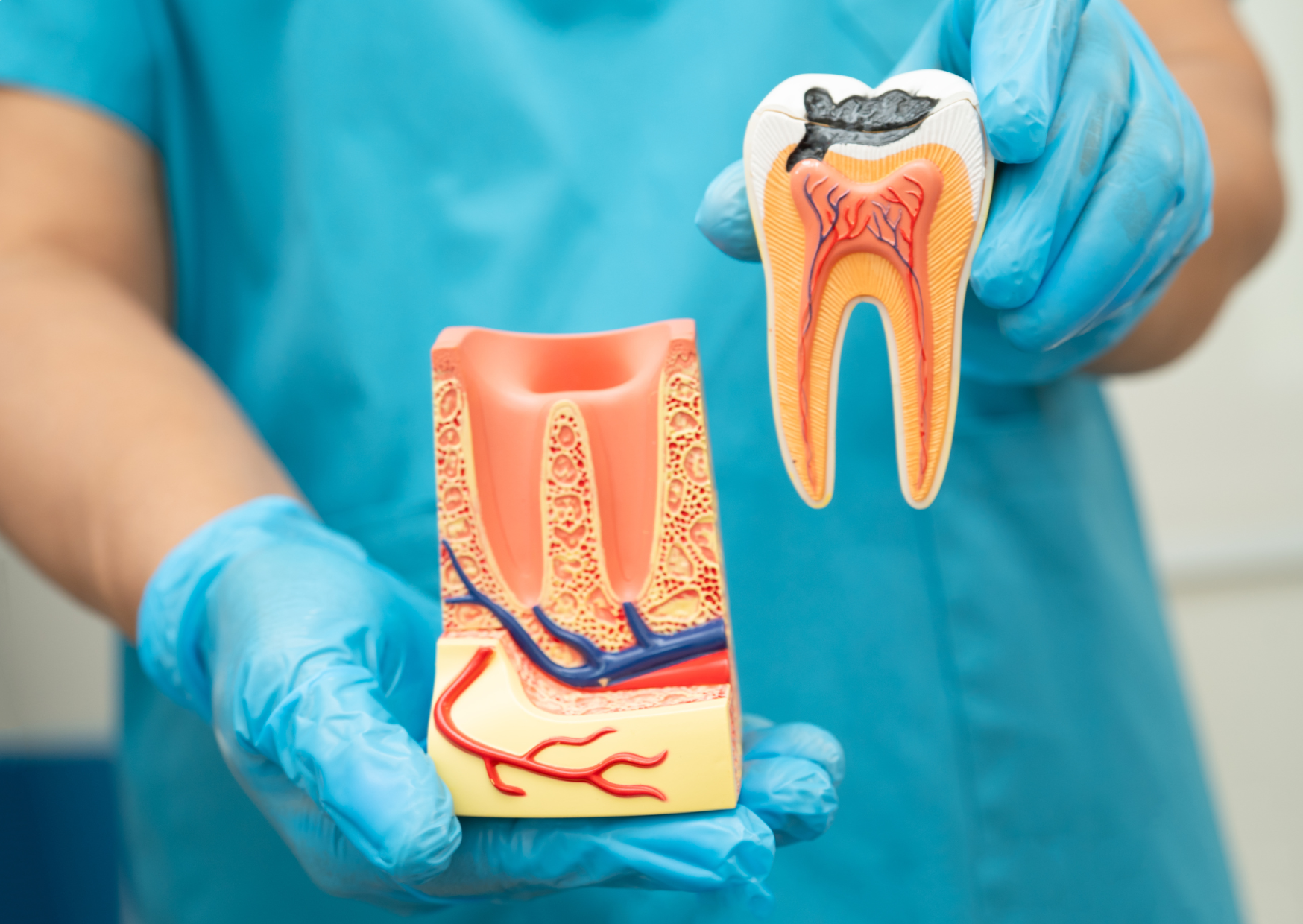 Blue-gloved hands hold two brightly colored tooth anatomy models in front of a turquoise garment. One model shows a cutaway tooth with red and blue branching lines inside the crown and root, while the other displays a larger cross-section of surrounding tissue. The models use cream, coral, red, and blue colors, with no legible text.