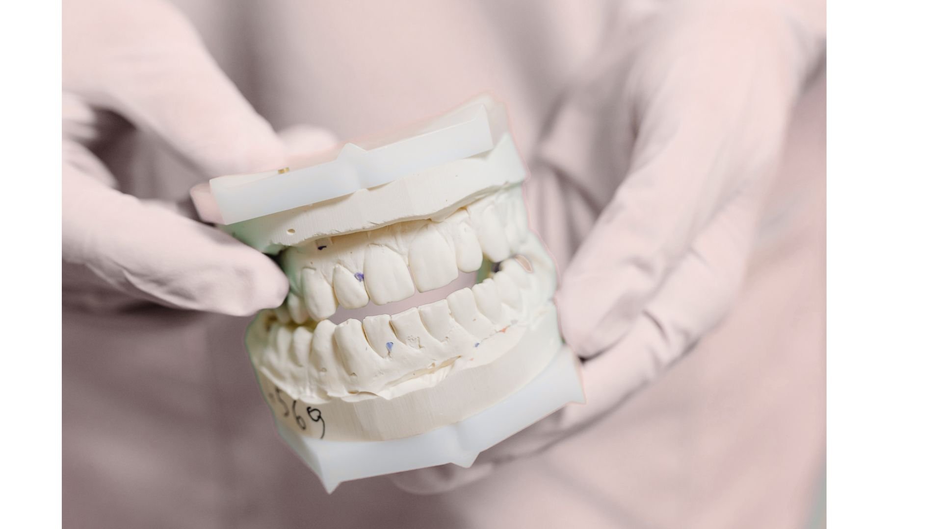 A pair of hands holds a white dental jaw model with upper and lower rows of teeth. The model is angled toward the camera, with small colored marks visible on several teeth and dark handwritten marks near its lower edge. The background is softly blurred and pale.